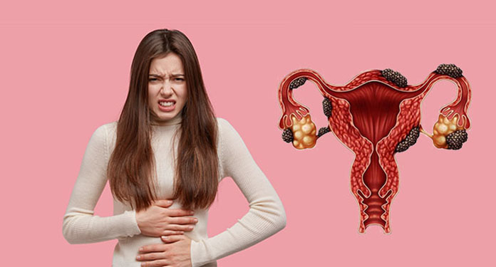 endometriozis farkındalık ayı mart