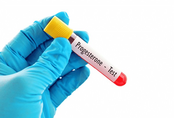 IVF Tedavisinde Progesteron