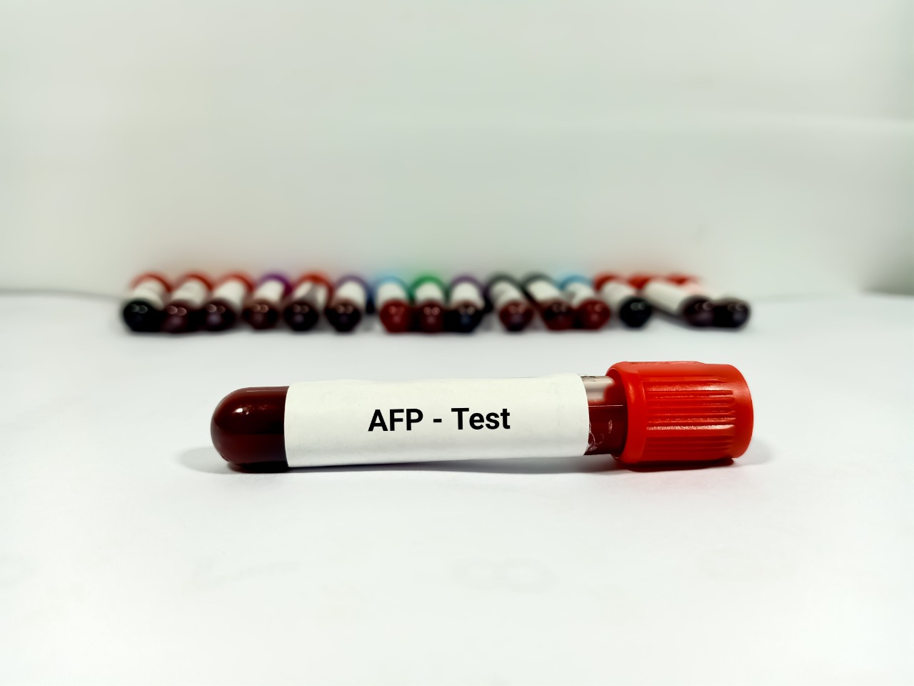 Alfa Fetoprotein Testi (AFP) Nedir