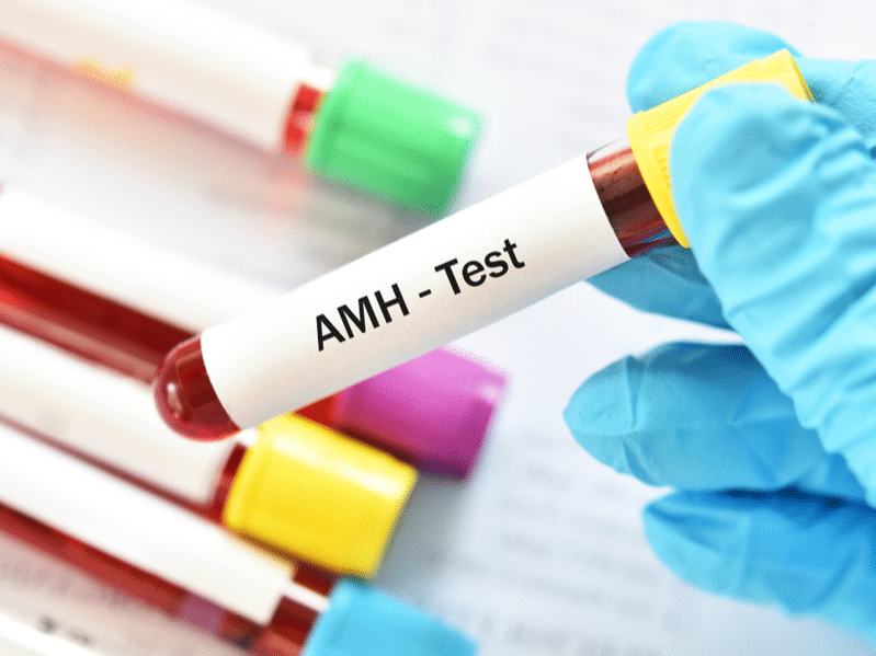 AMH Testi Nedir