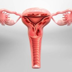 Adenomyozis Nedir