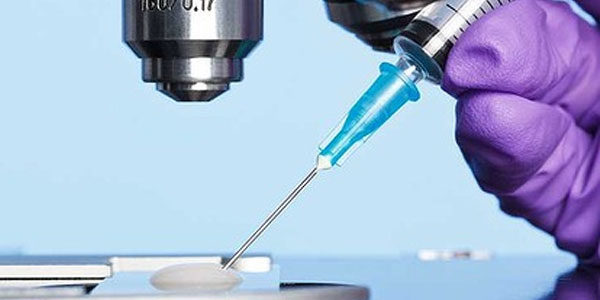 Sperm Donasyonu.