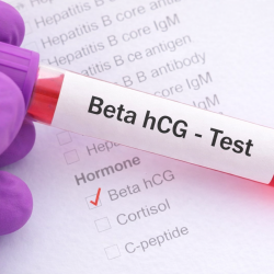 Beta HCG Ne Zaman Ölçülür