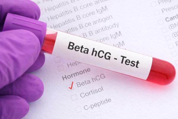 Beta HCG Ne Zaman Ölçülür