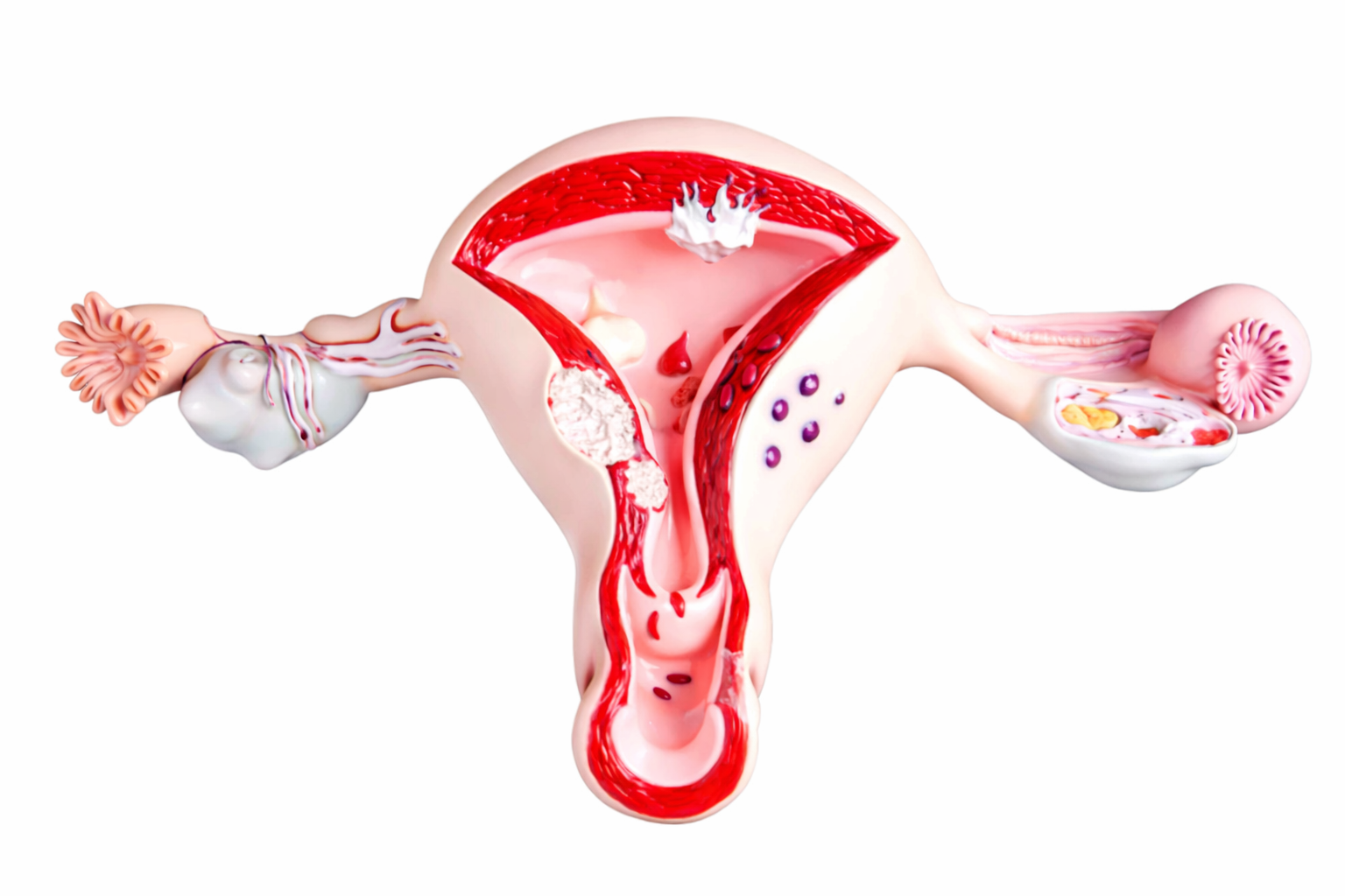 Rahimde Perde Nedir? (Uterin Septum) Belirtileri ve Tüp Bebek Sürecine Etkisi