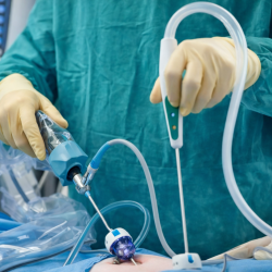 İdrar Kaçırma Ameliyatı