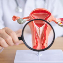 Rahim İçi Perde Ameliyatı
