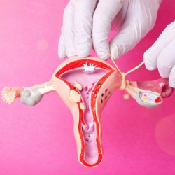 Tüplerin Bağlanması