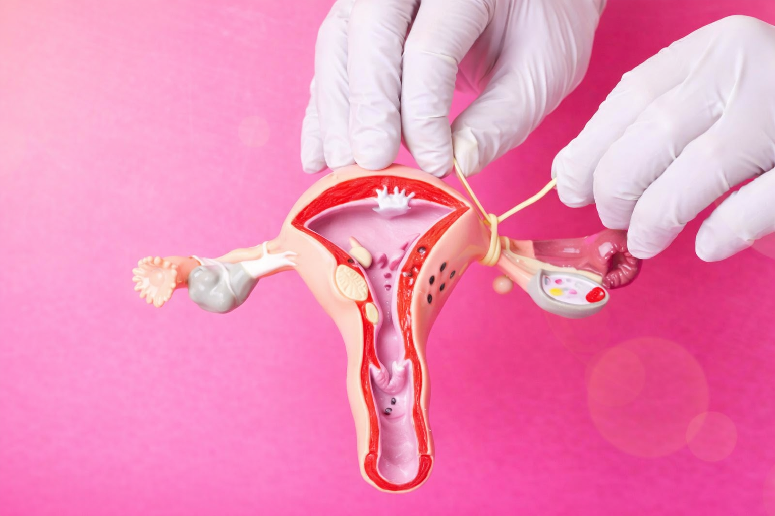 Tüplerin Bağlanması